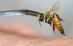 Bị hơn 20.000 con ong 'sát thủ' đốt, thanh niên Mỹ phải thở máy