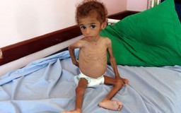 13 triệu người Yemen đối mặt thảm họa thiếu đói trong 3 tháng tới