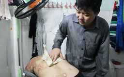 Vợ bị tạt axit, chồng yêu thương tắm cho vợ giúp xoa dịu nỗi đau