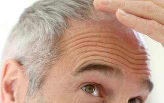 4 điều nhiều người chưa biết về tóc bạc