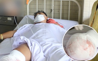 Thiếu niên Tây Ninh bị chém đứt lìa chân không thể nối lại