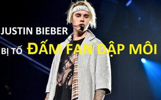 Justin Bieber bị tố đấm fan dập môi