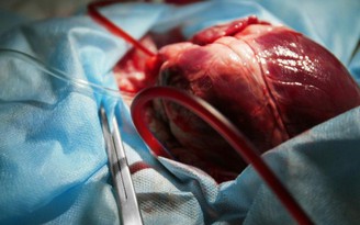 Ghép tim lợn cho người mở ra hy vọng cho nhiều bệnh nhân chờ ghép tạng