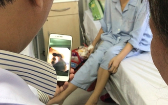 Hy hữu: Lấy ra 250 viên sỏi mật trong người cô gái 20 tuổi