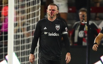Rụng rời với gương mặt đầy máu vì chấn thương của Rooney