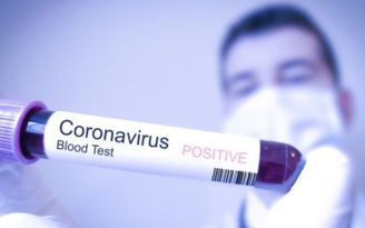 Virus corona chủng mới tồn tại trong không khí 3 giờ, trên nhựa và inox đến 3 ngày