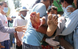 Cảnh sát, quân đội Myanmar nổ súng trấn áp biểu tình, ít nhất 18 người thiệt mạng