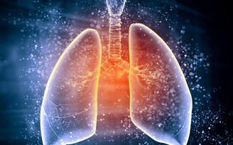 Ung thư phổi - căn bệnh 'thầm lặng' mà đáng sợ hơn bạn tưởng