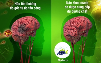 Đau đầu do thời tiết: Chớ dập lửa bằng rơm