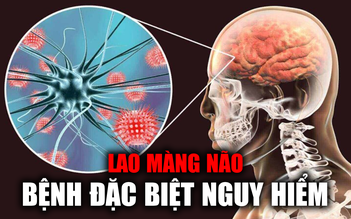 Bé gái 2 tháng tuổi bị lao màng não: Không chẩn đoán được bệnh, biến chứng đầu to