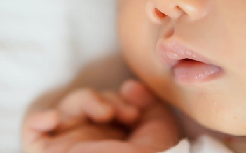 Mỹ: Cô bé sinh ra có đến... 2 cái miệng