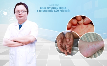 Bác sĩ giải đáp: Bệnh tay chân miệng ở trẻ và những sai lầm của cha mẹ