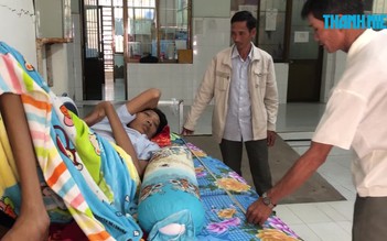 Cà Mau: Bệnh nhân nam cao 2,5m khổ sở trăm bề