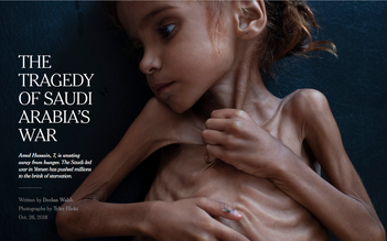 'Kiểm duyệt' ảnh em bé Yemen suy dinh dưỡng, Facebook bị phản đối