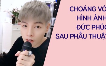 Đức Phúc đẹp như sao Hàn sau phẫu thuật thẩm mỹ?