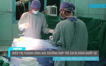 Điều trị thành công hai trường hợp trẻ em bị dính khớp sọ