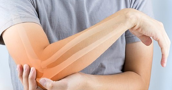 Bế bạn gái 65 kg, chàng trai gãy tay phải... nhập viện