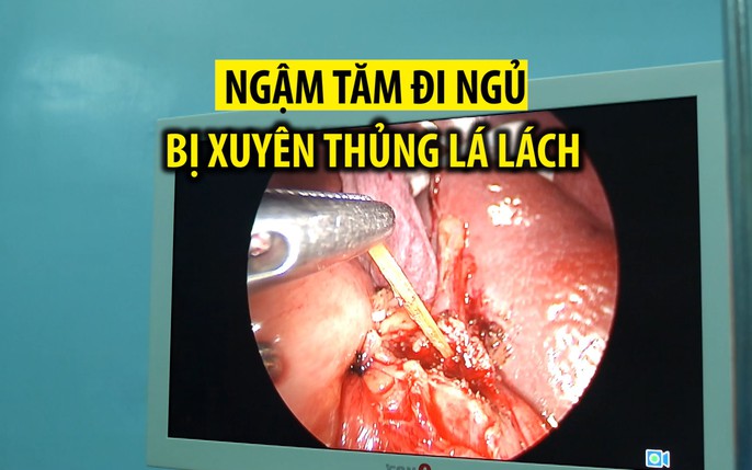 tăm đâm thủng bụng: tin tức, hình ảnh, video, bình luận