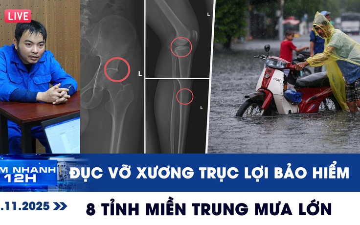 Xem nhanh 12h ngày 15.11: Ớn lạnh chiêu trò đục vỡ xương trục lợi bảo hiểm | 8 tỉnh miền Trung mưa lớn