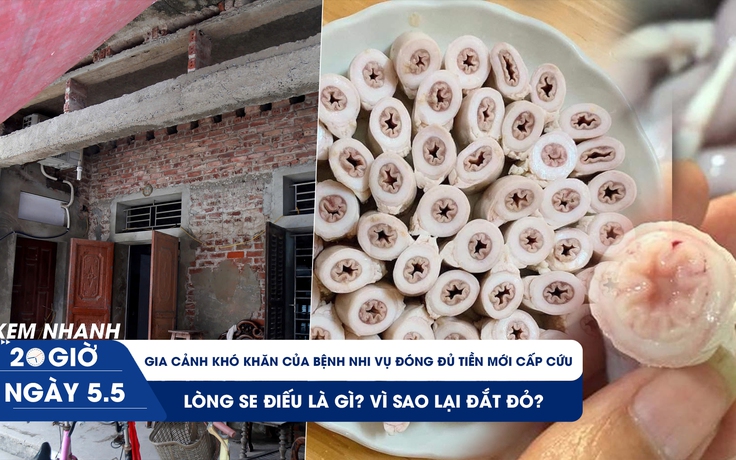 Xem nhanh 20h ngày 5.5: Lòng se điếu là gì? | Gia cảnh khó khăn của bệnh nhi vụ đóng đủ tiền mới cấp cứu