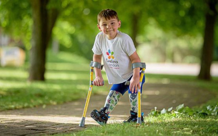 Xúc động bé 5 tuổi trên đôi chân giả đi bộ 10 cây số gây quỹ cho bệnh viện
