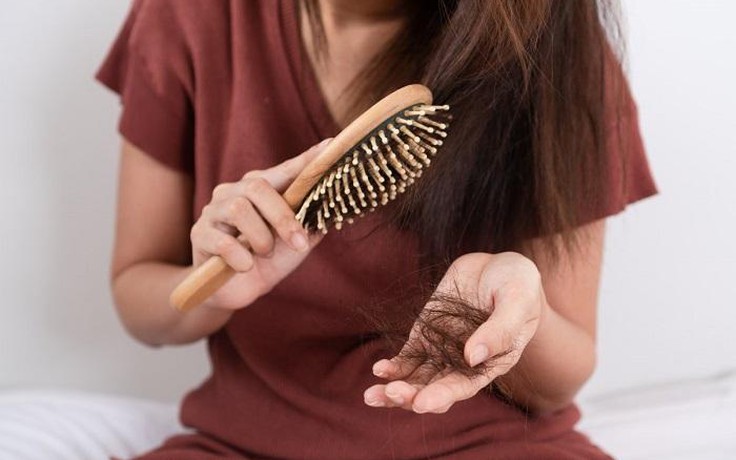 Covid-19 qua đi mà nỗi lo rụng tóc còn dai dẳng, phải làm sao? Covid-19 qua đi mà nỗi lo rụng tóc còn dai dẳng, phải làm sao?