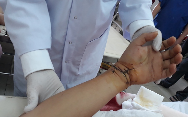 BV Đà Nẵng ghép nối thành công bàn tay bị đứt lìa cho bệnh nhân