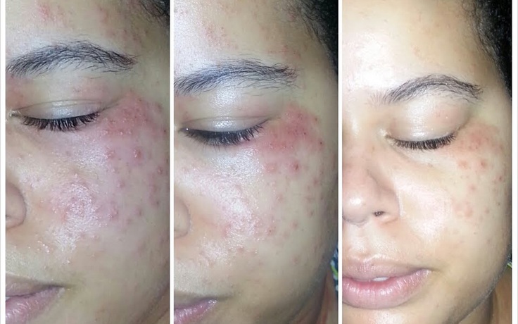 Lựa chọn thông minh cứu làn da khỏi hư hại