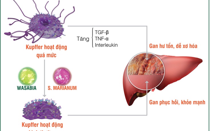 Xơ gan và ung thư gan - “đợi” chữa trị, đã quá muộn!