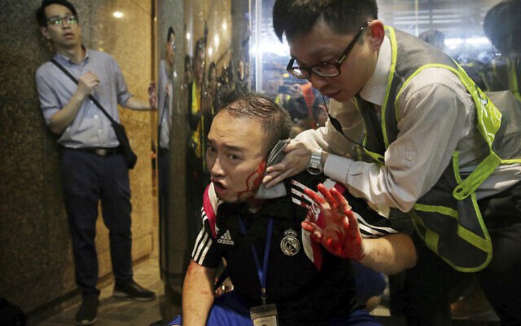 Đụng độ đẫm máu, một chính trị gia bị cắn đứt tai ở Hồng Kông