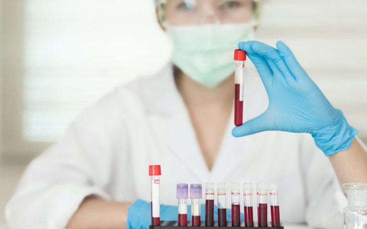 Người thuộc nhóm máu nào dễ có nguy cơ sa sút trí tuệ? Người thuộc nhóm máu nào dễ có nguy cơ sa sút trí tuệ?