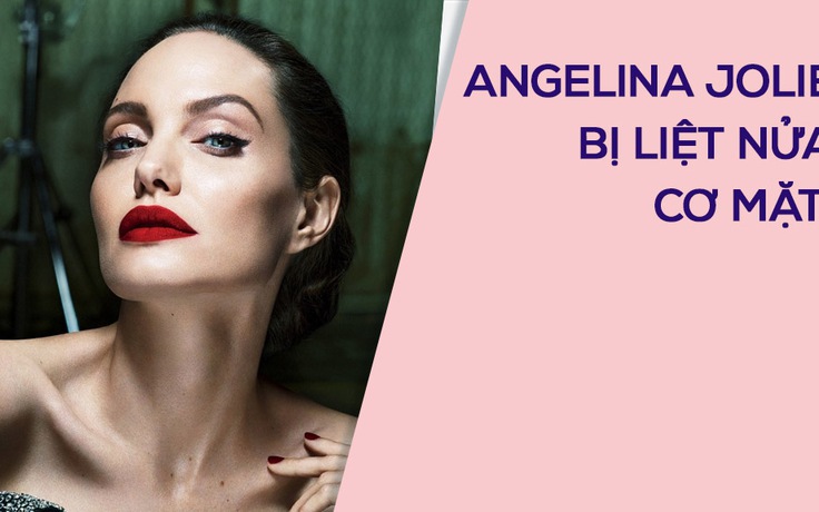 Angelina Jolie phải châm cứu vì liệt nửa cơ mặt