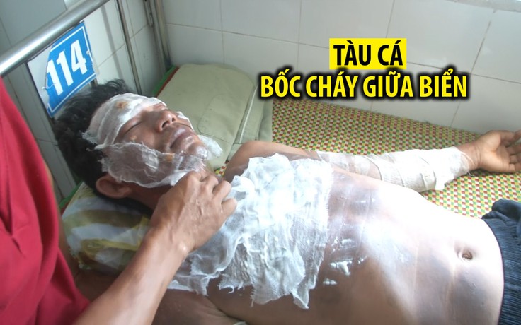 Tàu cá bốc cháy kinh hoàng giữa biển, 2 ngư dân bị bỏng