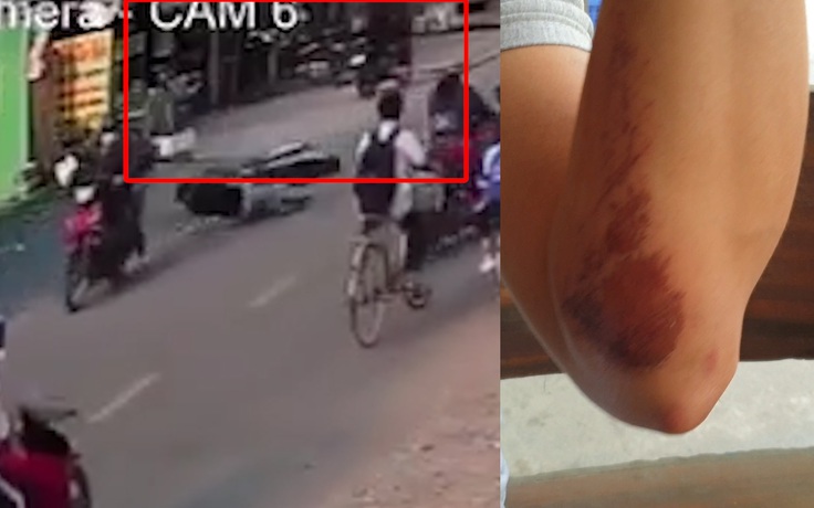 Kinh hoàng cảnh cướp giật dây chuyền “khủng” khiến nạn nhân ngã sấp mặt trên đường