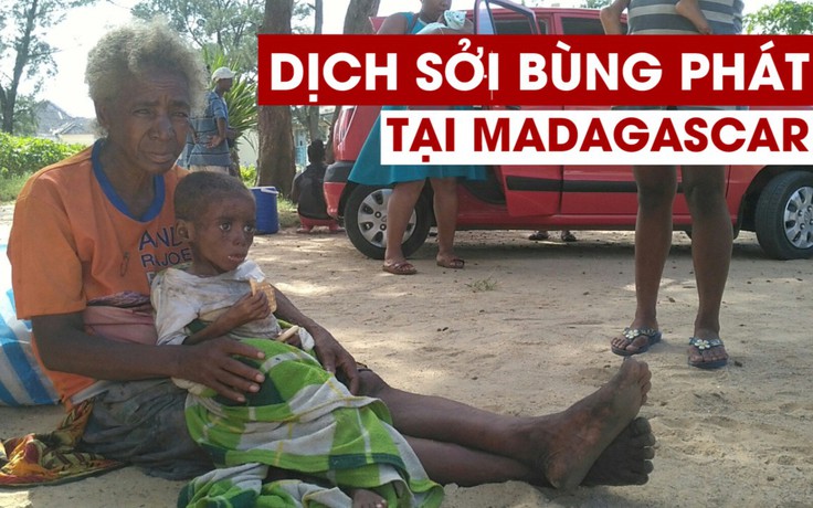 Thiếu vắc xin, 1.000 người chết vì dịch sởi trong 5 tháng qua ở Madagascar