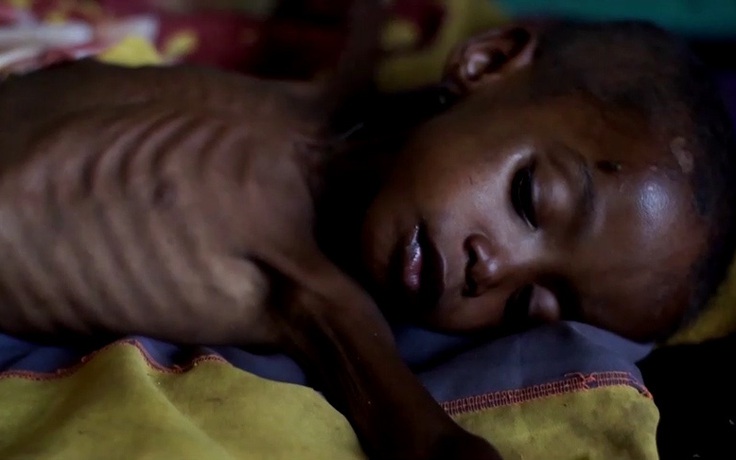 Hơn 1 triệu người đối mặt nạn đói vì hạn hán, mất mùa ở Madagascar