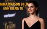 Người đẹp Emma Watson bị lộ ảnh riêng tư