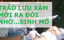 Xăm xóa sẹo sinh mổ, các mẹ có muốn thử?