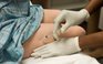 Chuyên gia Hồng Kông: tiêm vắc xin Covid-19 Pfizer vào đùi an toàn hơn tiêm vào tay