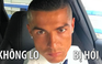 Ronaldo kinh doanh dịch vụ chống rụng tóc