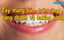 Mẹo vặt: Tẩy mảng bám trên răng chỉ với chanh và baking soda