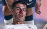 Highlights Séc 0-4 Bồ Đào Nha: Ronaldo đổ máu trong ngày đội nhà thắng đậm