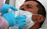 Mỹ lo nguy cơ mất kiểm soát dịch Covid-19, tổng thống Brazil nói có thể đã nhiễm bệnh