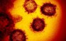 Virus corona có thể đã gây dịch bệnh tại Việt Nam từ 20.000 năm trước
