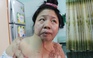 Người vợ vá xe bị tạt axit ở Sài Gòn: ‘Người lạ mặt’ đề nghị rút đơn